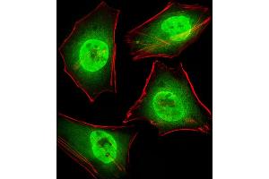 Fluorescent image of Hela cells stained with GTF2I Antibody . (GTF2I anticorps  (C-Term))