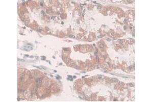 DAB staining on IHC-P Samples:Human Stomach Tissue