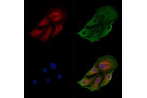 ABIN6259710 and ABIN6278976 staining Hela cells by IF/ICC.