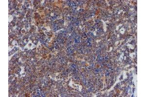 Image no. 15 for anti-ATR Interacting Protein (ATRIP) (AA 42-309) antibody (ABIN1491507)