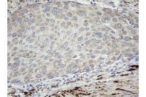 Image no. 2 for anti-Coagulation Factor XIII, A1 Polypeptide (F13A1) antibody (ABIN1498152) (F13A1 anticorps)
