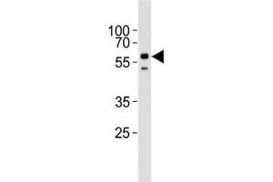 Western blot analysis of lysate from HepG2 cell line using ALK2 antibody