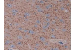 Detection of ICAM1 in Rat Cerebrum Tissue using Polyclonal Antibody to Intercellular Adhesion Molecule 1 (ICAM1)
