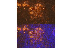 Immunofluorescence analysis of mouse spleen using CXCR5 Rabbit mAb (ABIN7266321) at dilution of 1:100 (40x lens). (CXCR5 anticorps)
