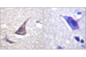 Immunohistochemistry analysis of paraffin-embedded human brain tissue, using C/EBP-epsilon (Ab-74) Antibody. (CEBPE anticorps  (AA 40-89))