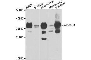 Western blot analysis of extracts of various cell lines, using AKR1C4 antibody. (AKR1C4 anticorps  (AA 1-323))