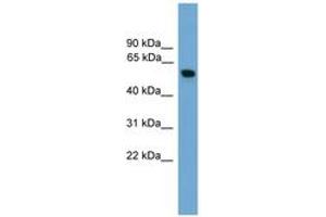 Image no. 1 for anti-Pyruvate Kinase, Muscle (PKM) (AA 391-440) antibody (ABIN6745581) (Pyruvate Kinase, Muscle (PKM) (AA 391-440) anticorps)