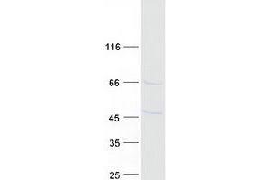 Validation with Western Blot
