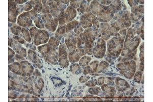 Image no. 1 for anti-serpin Peptidase Inhibitor, Clade B (Ovalbumin), Member 3 (SERPINB3) antibody (ABIN1500886)