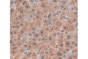 IHC-P analysis of liver tissue, with DAB staining. (FARS2 anticorps  (AA 1-451))
