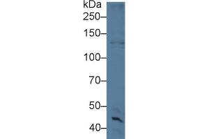 Western Blot; Sample: Human Hela(10u) cell lysate; Primary Ab: 5µg/ml Rabbit Anti-Mouse CYTSB Antibody Second Ab: 0.