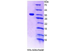 SDS-PAGE analysis of Rat PTPN22 Protein. (PTPN22 Protéine)