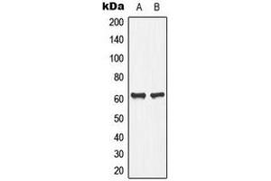 Western blot analysis of PLA2G4C expression in Jurkat (A), human pancreas (B) whole cell lysates.