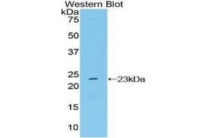 Western Blotting (WB) image for anti-NME/NM23 Nucleoside Diphosphate Kinase 6 (NME6) (AA 1-184) antibody (ABIN1860010)