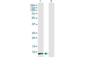 Western Blot analysis of TIMM8B expression in transfected 293T cell line by TIMM8B monoclonal antibody (M15), clone 8E5. (TIMM8B anticorps  (AA 1-83))