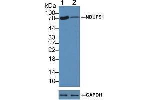 Knockout Varification: Lane 1: Wild-type A549 cell lysate, Lane 2: NDUFS1 knockout A549 cell lysate, Predicted MW: 81,79,74,68kd Observed MW: 74kd Primary Ab: 2 μg/mL Rabbit Anti-Human NDUFS1 Antibody Second Ab: 0.
