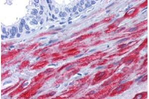 Human Prostate: Formalin-Fixed, Paraffin-Embedded (FFPE) (Smoothelin anticorps)