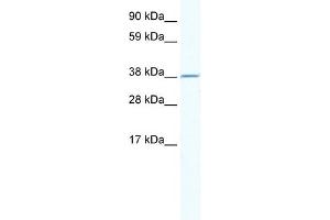 WB Suggested Anti-RNF130 Antibody Titration:  2. (RNF130 anticorps  (N-Term))