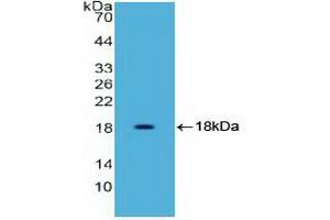 Detection of Recombinant HMGA1, Human using Polyclonal Antibody to High Mobility Group AT Hook Protein 1 (HMGA1) (HMGA1 anticorps)
