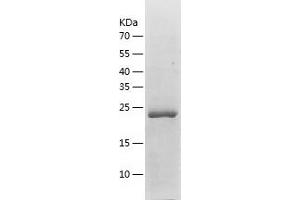 Western Blotting (WB) image for Zinc Finger Protein 22 (ZNF22) (AA 1-224) protein (His tag) (ABIN7125780) (Zinc Finger Protein 22 Protein (ZNF22) (AA 1-224) (His tag))