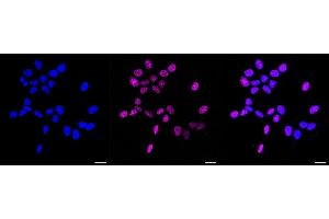 Immunocytochemical staining of HAP-1 cells with Phospho-Rad17 (S656) antibody (ABIN7800113), 1:1,000). (Recombinant RAD17 anticorps  (pSer656))