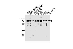 RP3 Antibody (N-term) (ABIN1881632 and ABIN2843271) western blot analysis in K562,MDA-M,NCI-,A549,293,Hela,CEM,NCI- cell line and human nomal uterus tissue lysates (35 μg/lane).