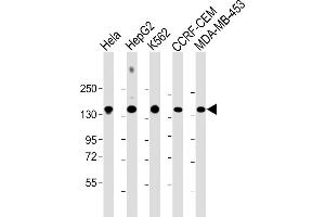 All lanes : Anti-C3 Antibody (C-term) at 1:2000 dilution Lane 1: Hela whole cell lysate Lane 2: HepG2 whole cell lysate Lane 3: K562 whole cell lysate Lane 4: CCRF-CEM whole cell lysate Lane 5: MDA-MB-453 whole cell lysate Lysates/proteins at 20 μg per lane. (C3 anticorps  (AA 1353-1382))