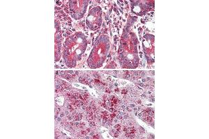 Immunohistochemistry (Formalin/PFA-fixed paraffin-embedded sections) of human small intestine (A) and human adrenal gland (B) tissue with GLP2R polyclonal antibody . (GLP2R anticorps  (C-Term))
