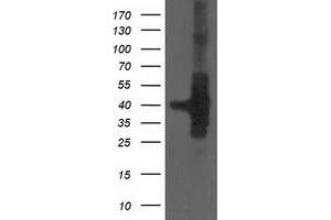 Western Blotting (WB) image for anti-HSPA Binding Protein, Cytoplasmic Cochaperone 1 (HSPBP1) antibody (ABIN1498759) (HSPBP1 anticorps)