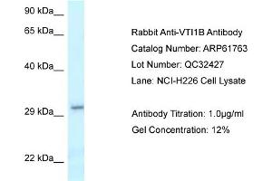 Western Blotting (WB) image for anti-Vesicle Transport through Interaction with T-SNAREs Homolog 1B (VTI1B) (C-Term) antibody (ABIN2788893) (VTI1B anticorps  (C-Term))