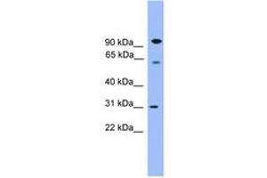 Image no. 1 for anti-Copine VI (CPNE6) (AA 401-450) antibody (ABIN6746586) (CPNE6 anticorps  (AA 401-450))