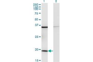 Western Blot analysis of RPL17 expression in transfected 293T cell line by RPL17 monoclonal antibody (M01), clone 3G11.