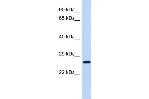 WB Suggested Anti-EFHD2 Antibody Titration: 0. (EFHD2 anticorps  (N-Term))