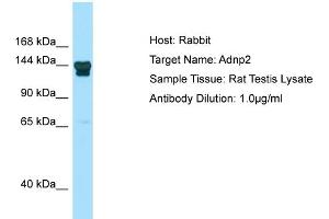 WB Suggested Anti-Adnp2 Antibody   Titration: 1.