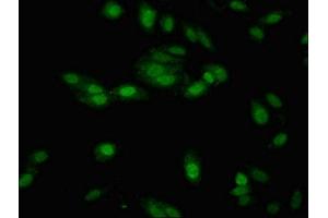 Immunofluorescent analysis of Hela cells using ABIN7151635 at dilution of 1:100 and Alexa Fluor 488-congugated AffiniPure Goat Anti-Rabbit IgG(H+L) (Nth Endonuclease III-Like 1 (NTHL1) (AA 31-312) anticorps)