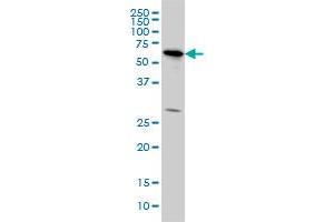 OXSR1 monoclonal antibody (M10), clone 3F6 Western Blot analysis of OXSR1 expression in HeLa . (OXSR1 anticorps  (AA 351-450))