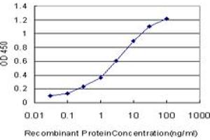 Detection limit for recombinant GST tagged OTX1 is approximately 0. (OTX1 anticorps  (AA 10-116))