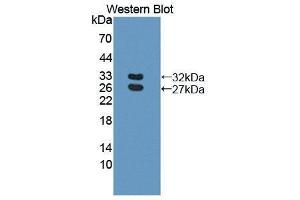 Western Blotting (WB) image for anti-Basal Cell Adhesion Molecule (Lutheran Blood Group) (BCAM) (AA 32-257) antibody (ABIN1866870) (BCAM anticorps  (AA 32-257))