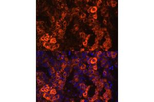 Immunofluorescence analysis of human liver cancer cells using BHMT antibody (ABIN3021749, ABIN3021750, ABIN3021751 and ABIN6215748) at dilution of 1:100.