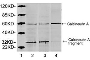 Lane 1: MarkerLane 2: Hela cell lysateLane 3: HEK293 cell lysateLane 4: NIH/3T3 cell lysateWestern blot analysis of cell lysates using 1 µg/mL Rabbit Anti-Calcineurin A Polyclonal Antibody (ABIN398733) The signal was developed with IRDyeTM 800 Conjugated Goat Anti-Rabbit IgG. (Calcineurin A anticorps  (AA 450-500))