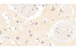 Detection of GABARAPL2 in Human Cerebrum Tissue using Polyclonal Antibody to GABA-A Receptor Associated Protein Like Protein 2 (GABARAPL2)