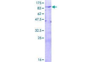 Image no. 1 for Ubiquitin Specific Peptidase 21 (USP21) (AA 1-565) protein (GST tag) (ABIN1324769)