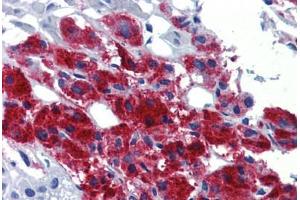 Human Adrenal (formalin-fixed, paraffin-embedded) stained with EGR2 antibody ABIN462263 followed by biotinylated goat anti-rabbit IgG secondary antibody ABIN481713, alkaline phosphatase-streptavidin and chromogen.