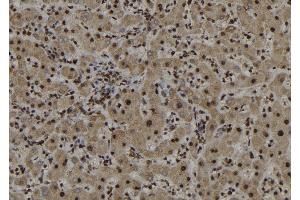 ABIN6272987 at 1/100 staining Human liver tissue by IHC-P.