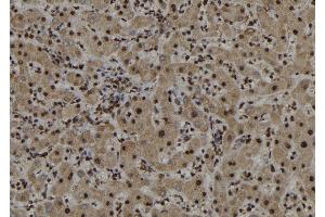 ABIN6272987 at 1/100 staining Human liver tissue by IHC-P.