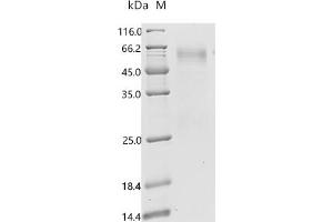 Interleukin 3 Receptor, alpha (IL3RA) (AA 19-305) (Active) protein (His tag)