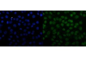 IF analysis of SNRPN using anti-SNRPN antibody (ABIN3043934). (SNRPN anticorps  (N-Term))