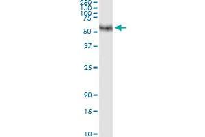 Immunoprecipitation of MMP8 transfected lysate using anti-MMP8 MaxPab rabbit polyclonal antibody and Protein A Magnetic Bead , and immunoblotted with MMP8 purified MaxPab mouse polyclonal antibody (B01P) .