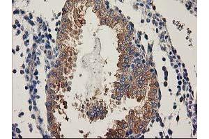 Image no. 5 for anti-Breast Cancer Anti-Estrogen Resistance 1 (BCAR1) antibody (ABIN1496834)