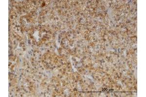 Image no. 1 for anti-Cerebellar Degeneration-Related Protein 2, 62kDa (CDR2) (AA 296-405) antibody (ABIN599360) (CDR2 anticorps  (AA 296-405))